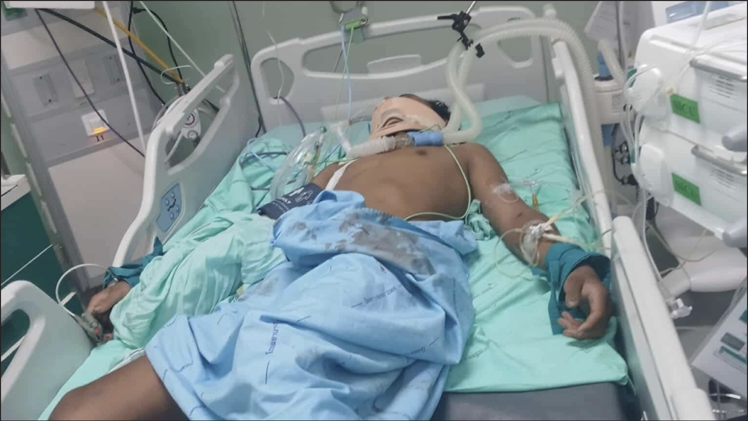 นักมวยไทยประสบอุบัติเหตุ